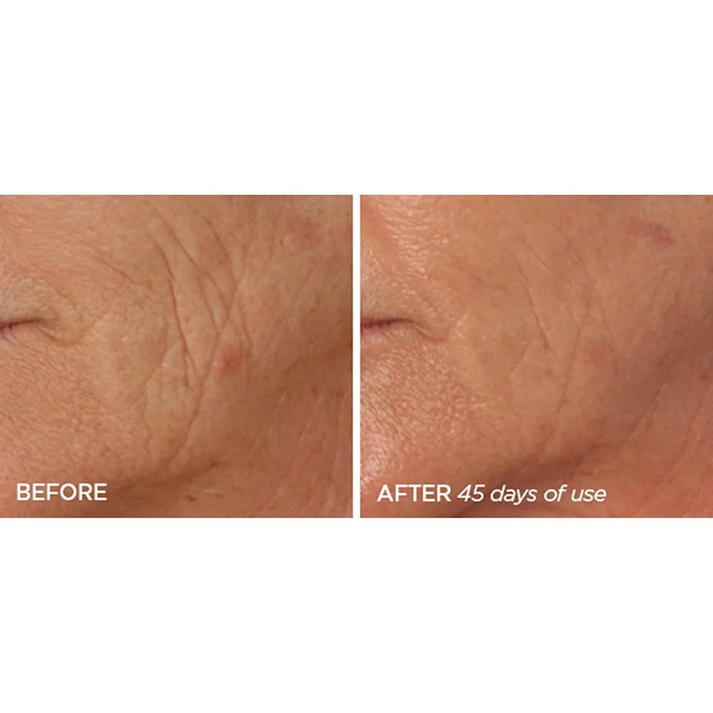 Beauty Bioscience R45 The Reversal 2 Phase Retinol Treatment Serum 4A & 4B