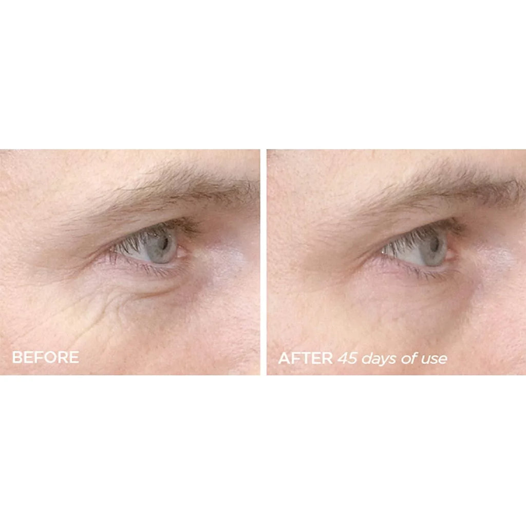 Beauty Bioscience R45 The Reversal 2 Phase Retinol Treatment Serum 4A & 4B
