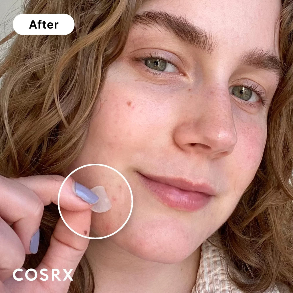 Cosrx Acne Pimple Patch Absorbing Hydrocolloid Original 3 Size Patches For Blemishes And Zits Shield Spot Stickers For Face And Body, Not Tested On Animals, No Toxic Ingredients (240 Count (Pack.